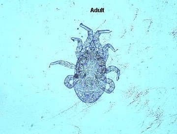 جنس درماسنتور