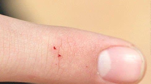 عنکبوت بیوه سیاه