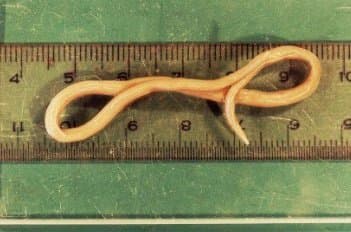 تخم بارور شده آسکاریس لومبریکوئیدس