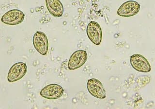 اوپیستورکیس