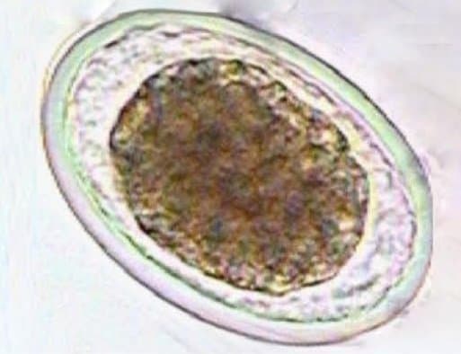 تخم بارور شده آسکاریس لومبریکوئیدس