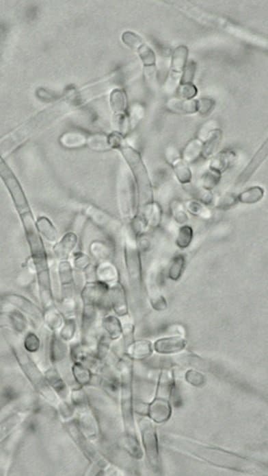 اوئیدیودندرون