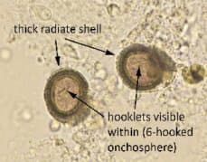 تنیا ساژیناتا