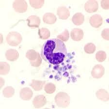 پدیده تجمع اقماری پلاکت‌ها در اطراف لکوسیت‌های نوتروفیل