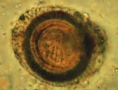 تنیا ساژیناتا