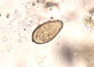 اوپیستورکیس