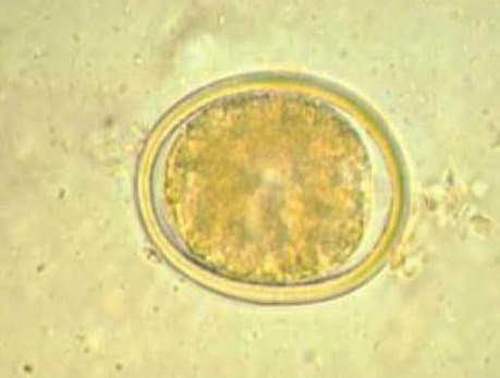 تخم بارور شده آسکاریس لومبریکوئیدس