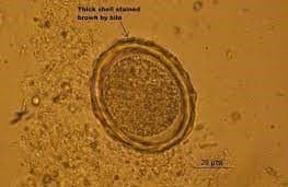 تخم بارور شده آسکاریس لومبریکوئیدس