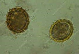 تخم بارور شده آسکاریس لومبریکوئیدس