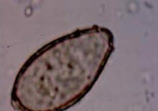 اوپیستورکیس