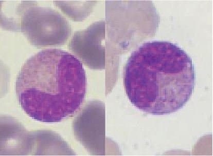 متامیلوسیت