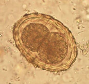 تخم بارور شده آسکاریس لومبریکوئیدس