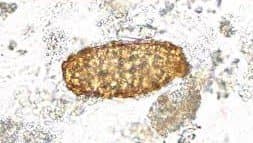 تخم بارور نشده آسکاریس لومبریکوئیدس