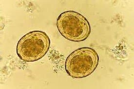 تخم بارور شده آسکاریس لومبریکوئیدس