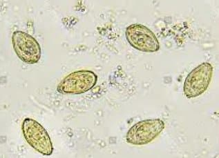 اوپیستورکیس