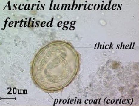 تخم بارور شده آسکاریس لومبریکوئیدس