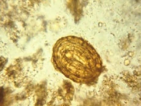 تخم بارور شده آسکاریس لومبریکوئیدس