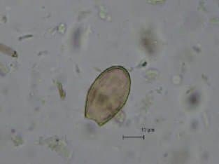 اوپیستورکیس