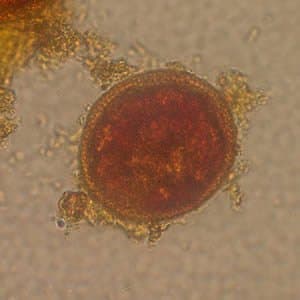 توکسوکارا کنیس