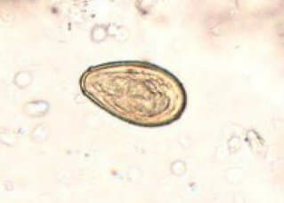 اوپیستورکیس