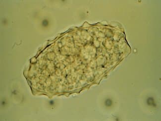 تخم بارور نشده آسکاریس لومبریکوئیدس