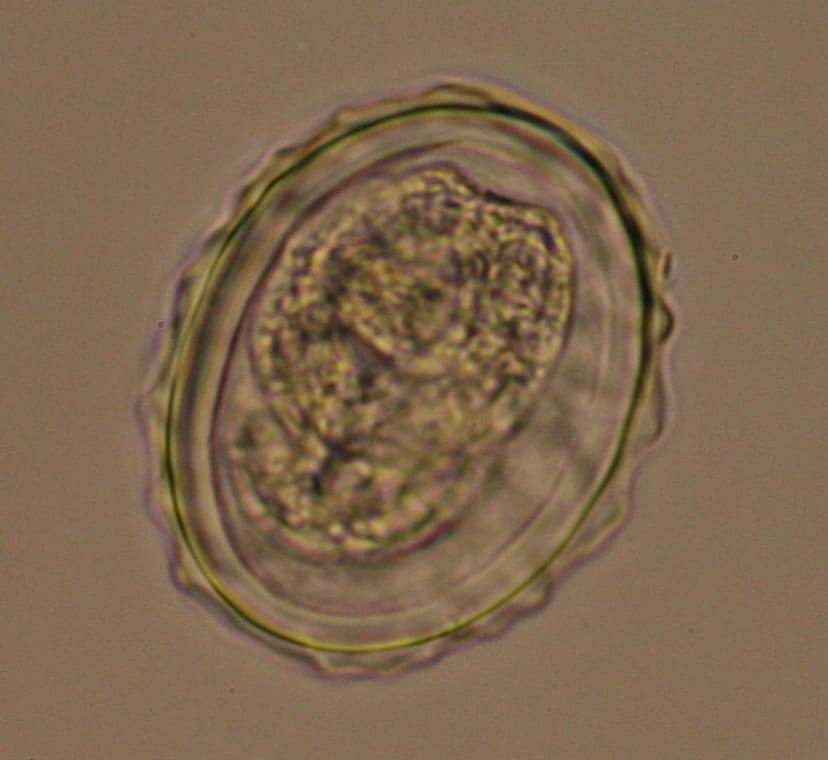 تخم بارور شده آسکاریس لومبریکوئیدس