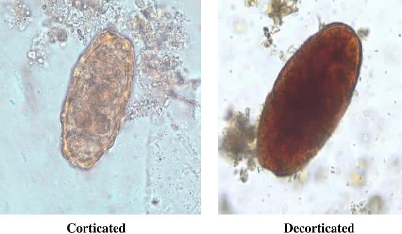 تخم بارور نشده آسکاریس لومبریکوئیدس