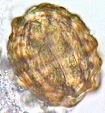 تخم بارور شده آسکاریس لومبریکوئیدس