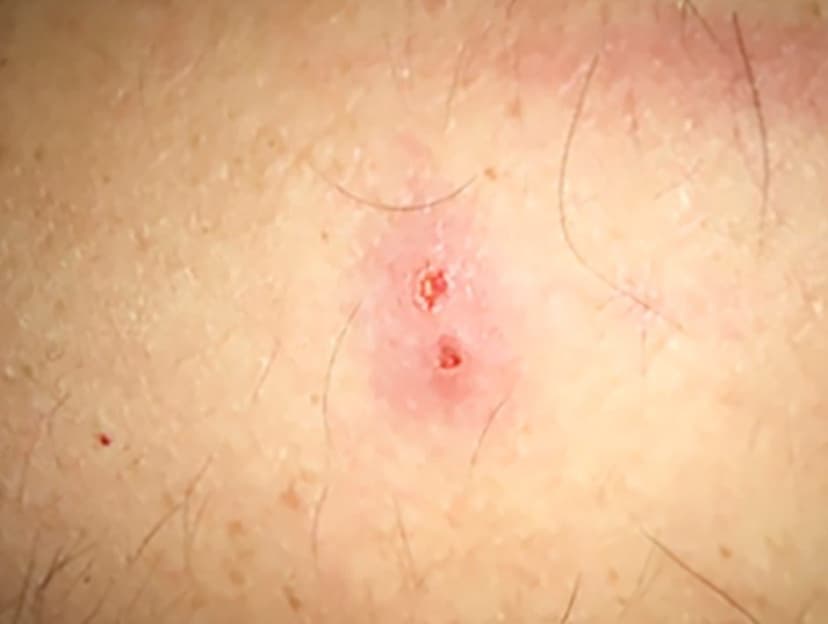 عنکبوت بیوه قهوه‌ای