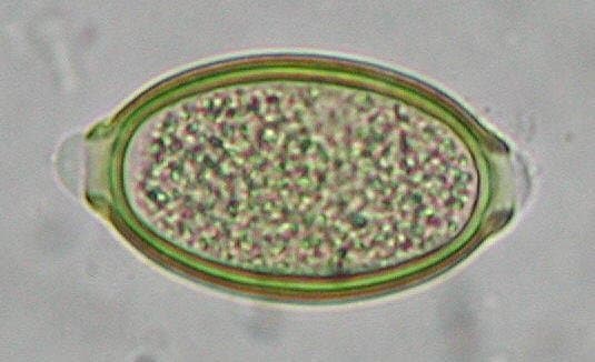 کاپیلاریا فیلیپینسیس