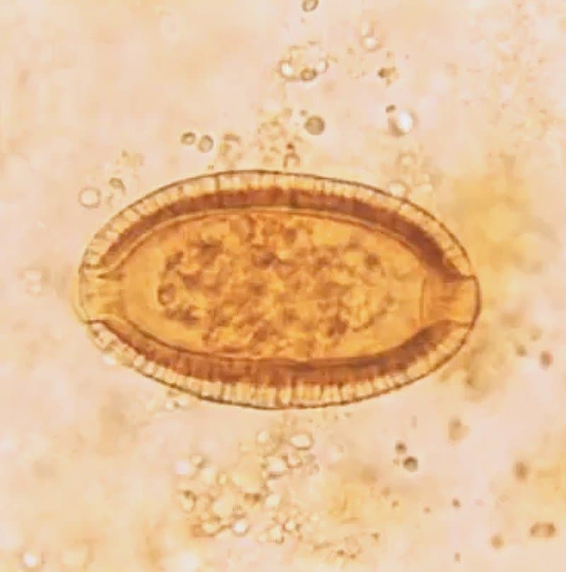 کاپیلاریا فیلیپینسیس