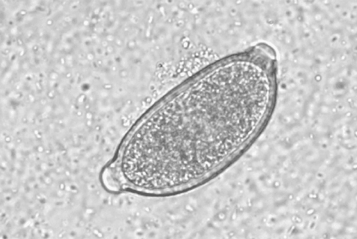 کاپیلاریا فیلیپینسیس