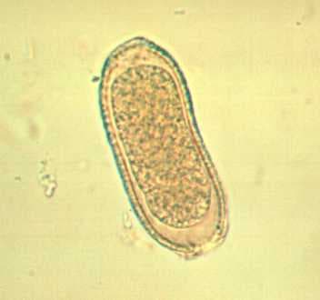 کاپیلاریا فیلیپینسیس