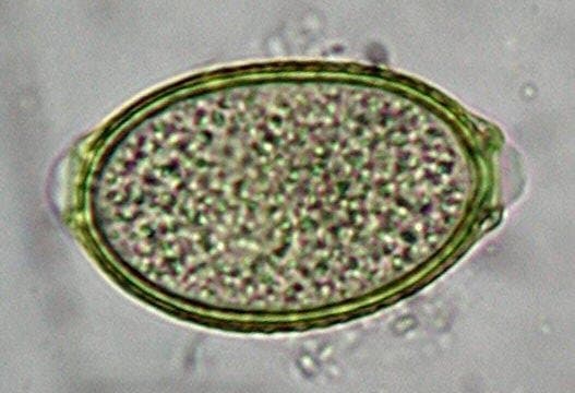 کاپیلاریا فیلیپینسیس