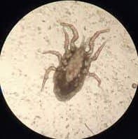 جنس درمانیسوس