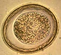 توکسوکارا کتی