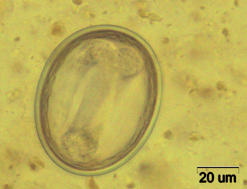 توکسوکارا کتی