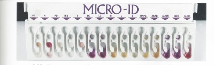 تشخیص اشرشیا کلی با استفاده از نوار MICRO-ID