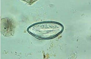 انتروبیوس ورمیکولاریس (اکسیور یا کرم سنجاقی)