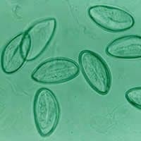 انتروبیوس ورمیکولاریس (اکسیور یا کرم سنجاقی)