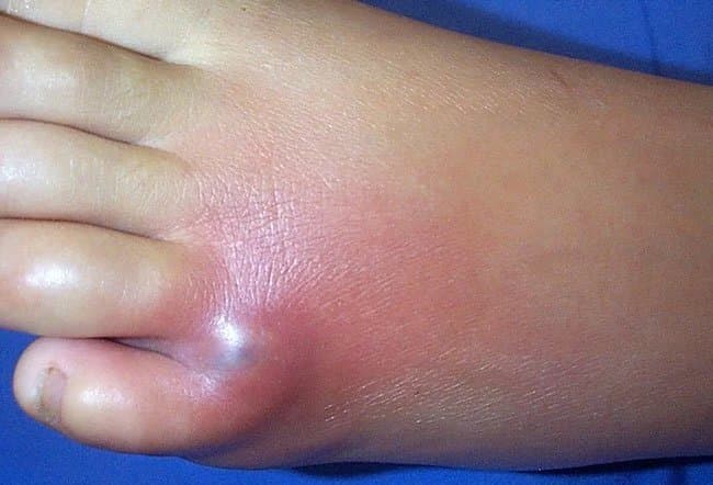 عنکبوت بیوه قهوه‌ای