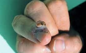 عنکبوت گوشه نشین قهوه‌ای