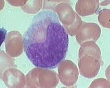 متامیلوسیت