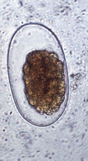 نکاتور آمریکانوس