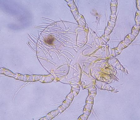 جنس نئوترومبیکولا