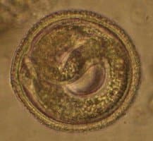 توکسوکارا کتی