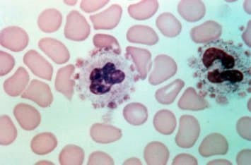 پدیده تجمع اقماری پلاکت‌ها در اطراف لکوسیت‌های نوتروفیل