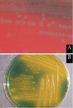 ویبریو کلرا  (V.cholerae) روی آگار خون دار و آگار TCBS