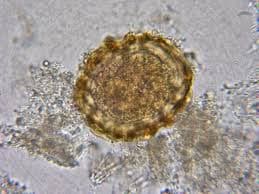 تخم بارور شده آسکاریس لومبریکوئیدس