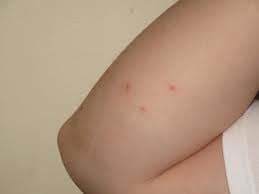 سیمکس لکتولاریوس